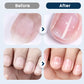 💅 Närande nagelreparationsspray – Stärker & lagar spröda naglar | SPARA 50% idag!